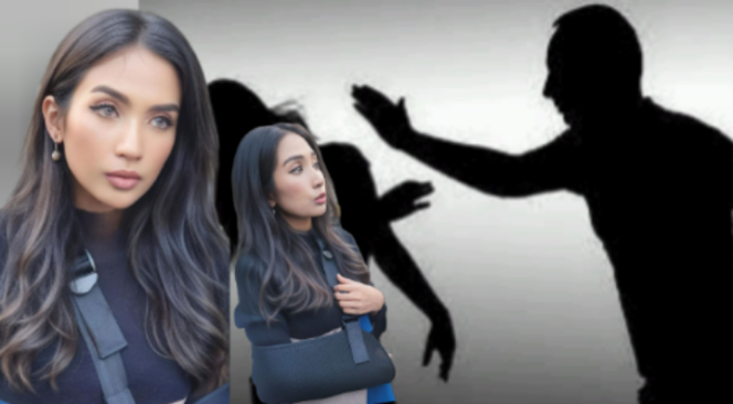 
 Ratu Aghnia Korban KDRT Alami Penganiayaan Fatal , Tulang Sikut Tangan kanan Geser,